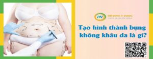 Tạo hình thành bụng không khâu da