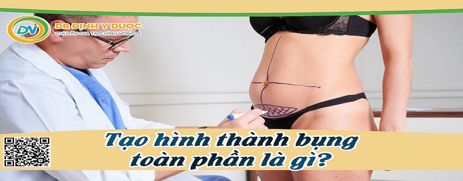 Tạo hình thành bụng toàn thể