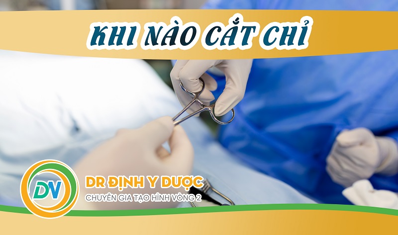 tạo hình thành bụng khi nào cắt chỉ