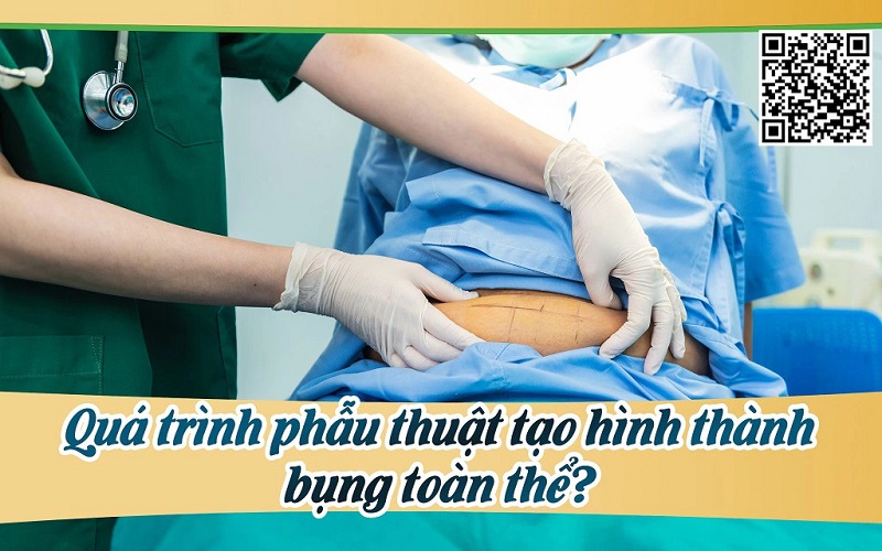 Quá trình phẫu thuật tạo hình thành bụng toàn thể?