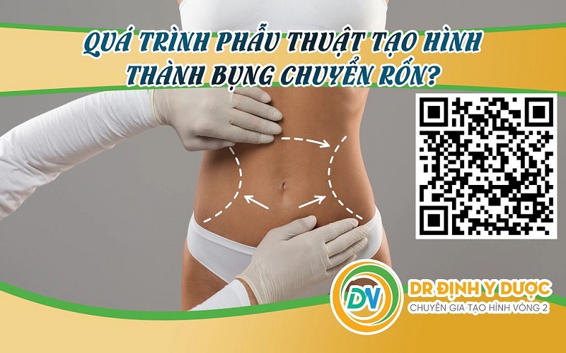 Quá trình phẫu thuật tạo hình thành bụng chuyển rốn