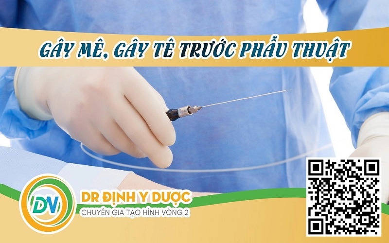 Gây mê, gây tê trước phẫu thuật tạo hình thành bụng chuyển rốn