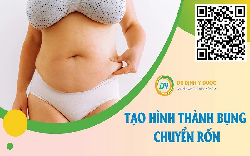 Phương pháp tạo hình thành bụng chuyển rốn