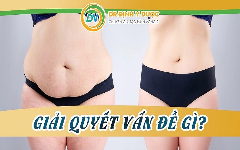 Tạo hình thành bụng giải quyết vấn đề gì?