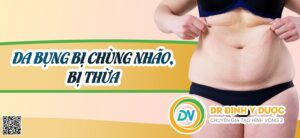 cách khắc phục da bụng nhăn sau sinh