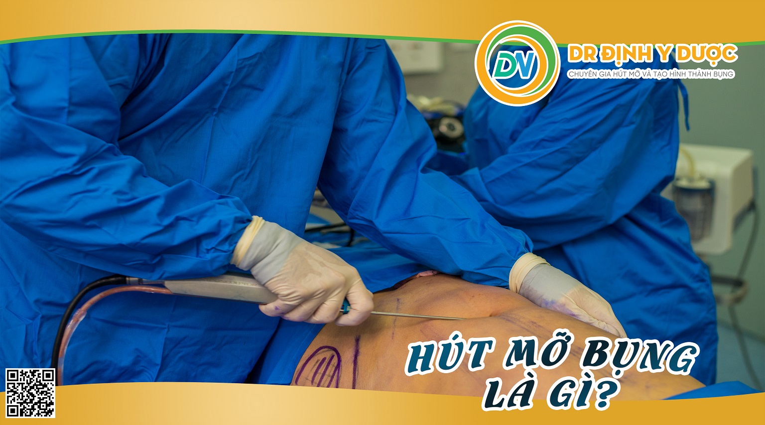 Phẫu Thuật Hút Mỡ Bụng Và 3 Lưu Ý Quan Trọng