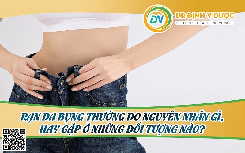 rạn da bụng thường do nguyên nhân gì, hay gặp ở những đối tượng nào?