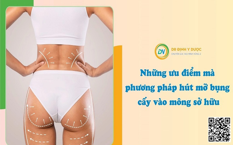 những ưu điểm mà phương pháp hút mỡ bụng cấy vào mông sở hữu