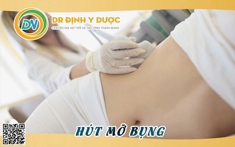 phẫu thuật hút mỡ bụng