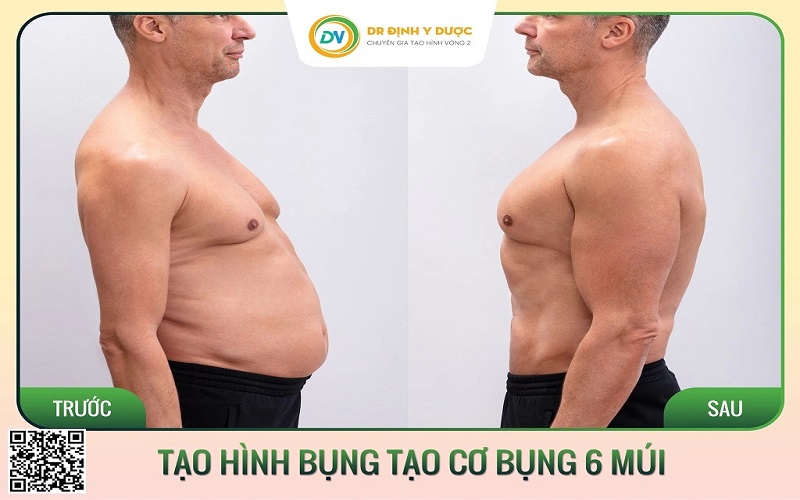 tạo cơ bụng 6 múi