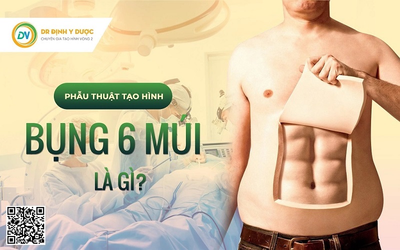 Phẫu thuật tạo hình tạo cơ bụng 6 múi là gì?