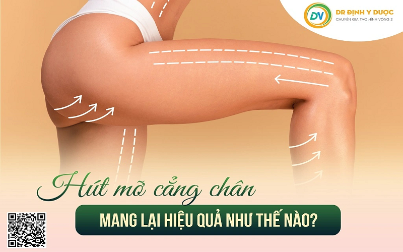 hút mỡ cẳng chân