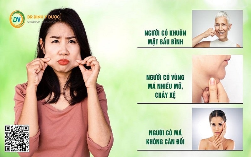 đối tượng nên hút mỡ má