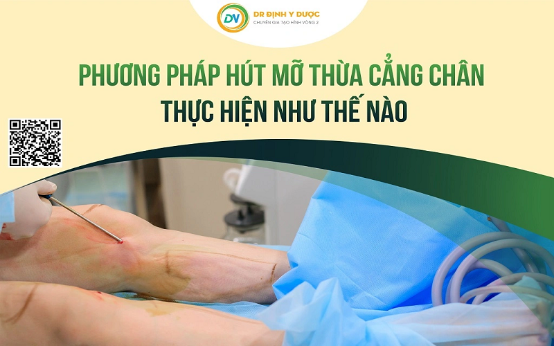 hút mỡ cẳng chân