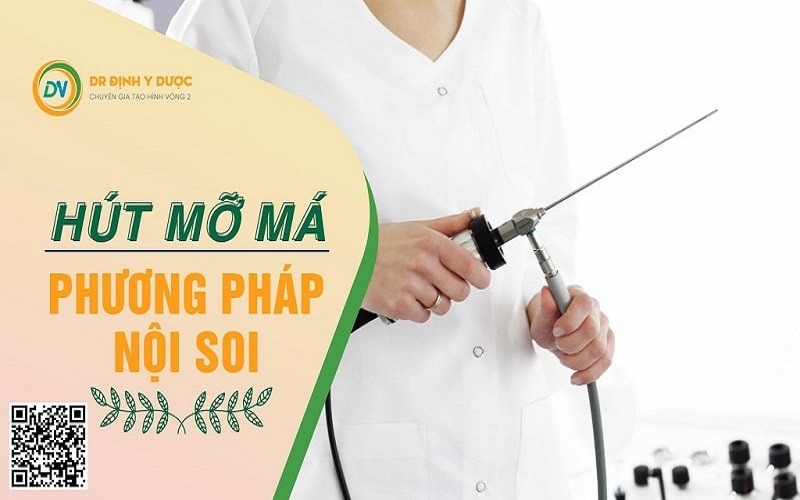 hút mỡ má nội soi