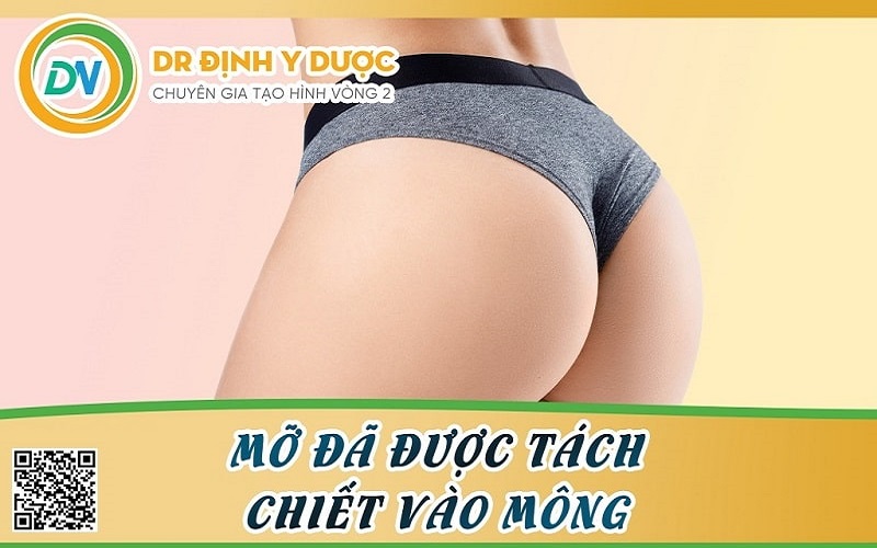 cấy mỡ mông