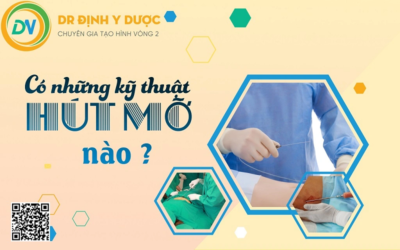 có những kỹ thuật hút mỡ phổ biến nào?