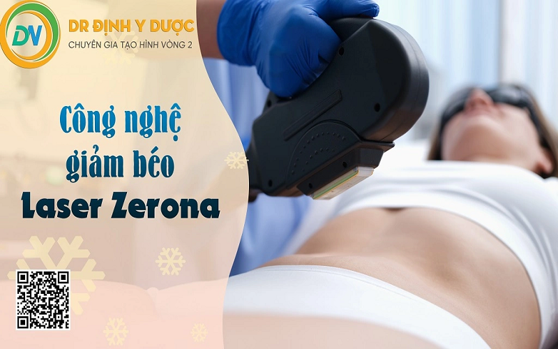 kỹ thuật hút mỡ bằng công nghệ giảm béo Laser Zerona