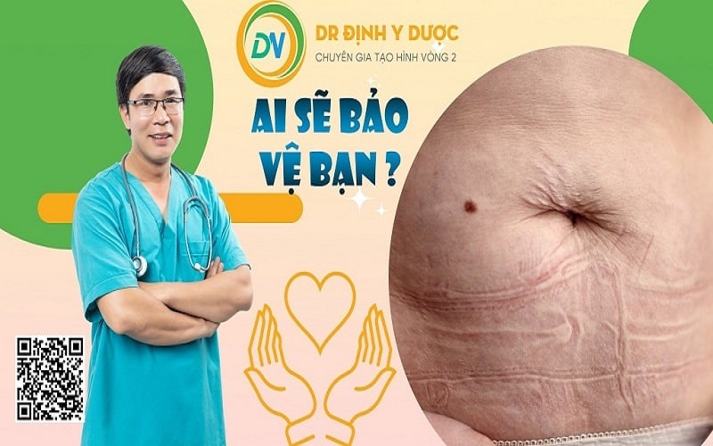 cách hút mỡ bụng tại nhà