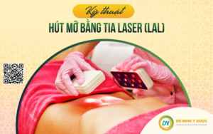 Công Nghệ Laser Hủy Mỡ Là Gì - So Sánh Công Nghệ Laser Với Hút Mỡ