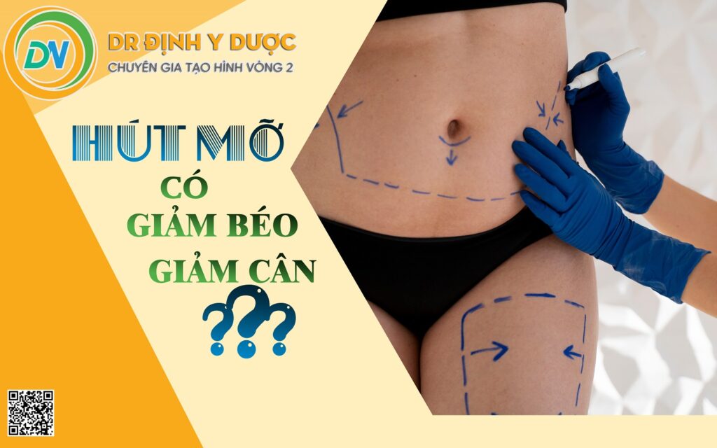 hút mỡ có thể giảm béo