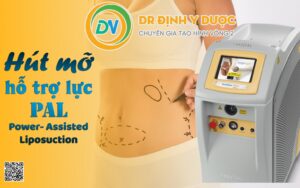 hút mỡ hỗ trợ bằng laser