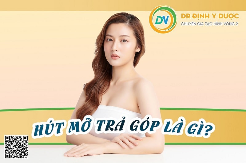 Thế nào là hút mỡ trả góp?