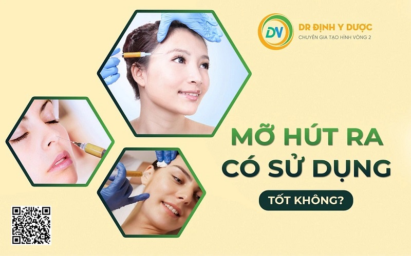 tạo hình thành bụng hút mỡ