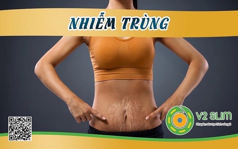 Biến chứng hút mỡ bụng