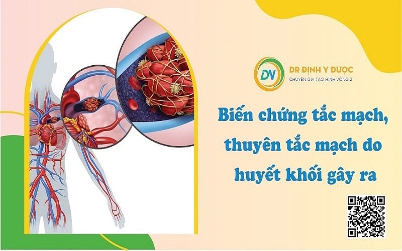 hút mỡ bụng có nguy hiểm ko