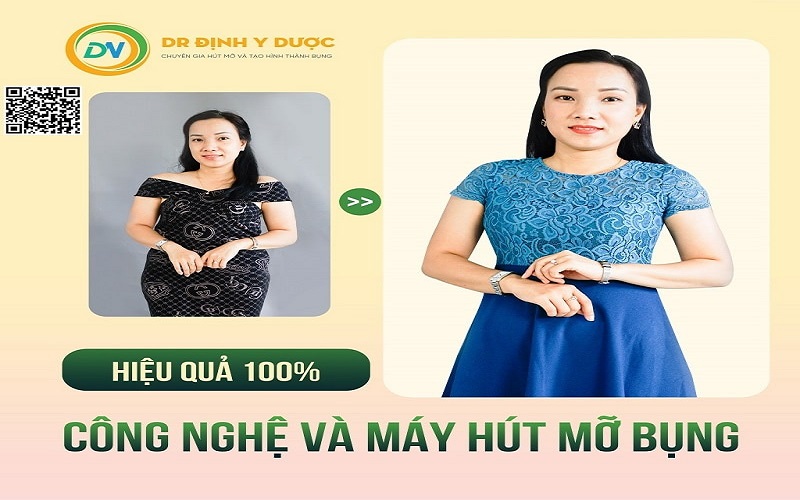 hút mỡ bụng công nghệ vaser