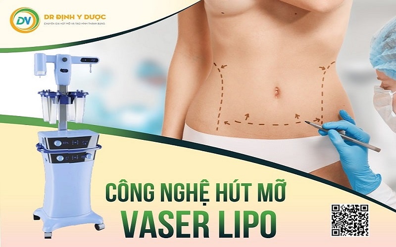 hút mỡ bụng công nghệ vaser