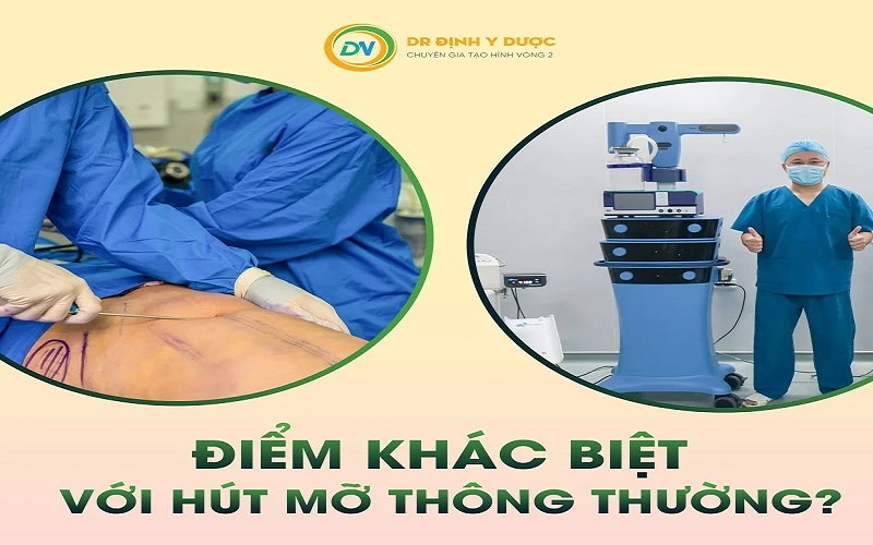 hút mỡ bụng công nghệ vaser