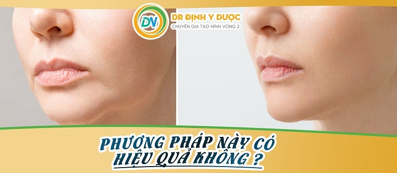 su-dung-cong-nghe-vaser-fat-co-hieu-qua-khong