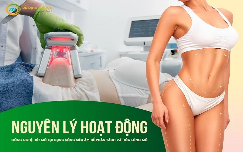 hút mỡ bụng công nghệ vaser lipo