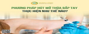 review hút mỡ bắp tay