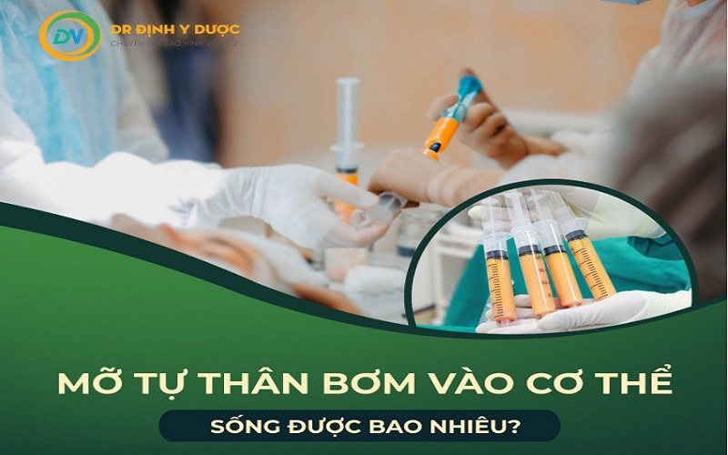 Nâng ngực cấy mỡ tự thân