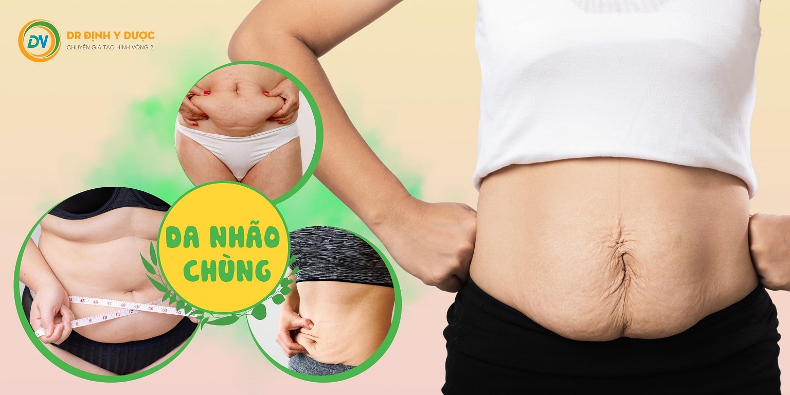 Phụ Nữ Sau Sinh Bao Lâu Thì Lấy Lại Vóc Dáng - Phương Pháp Giảm Mỡ An Toàn sau sinh bao lâu thì lấy lại vóc dáng