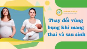 thay đổi cấu tạo bụng phụ juwx trong và sau sinh