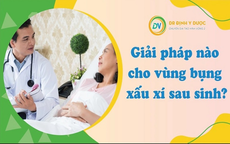 cấu tạo cơ bụng nữ