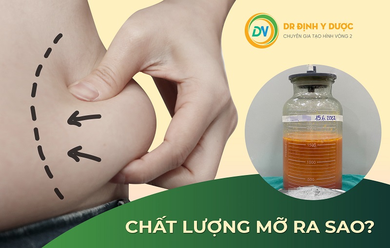 Tạo hình thành bụng hút mỡ