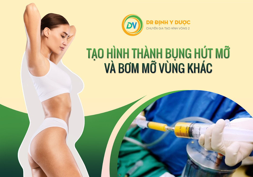 Tạo hình thành bụng