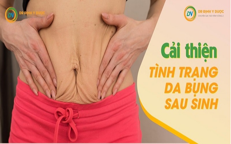 Da bụng bị chùng nhão sau sinh