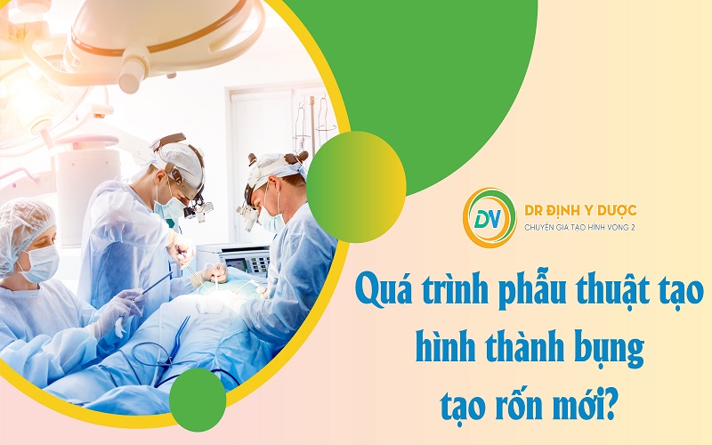 Tạo Hình Thành Bụng