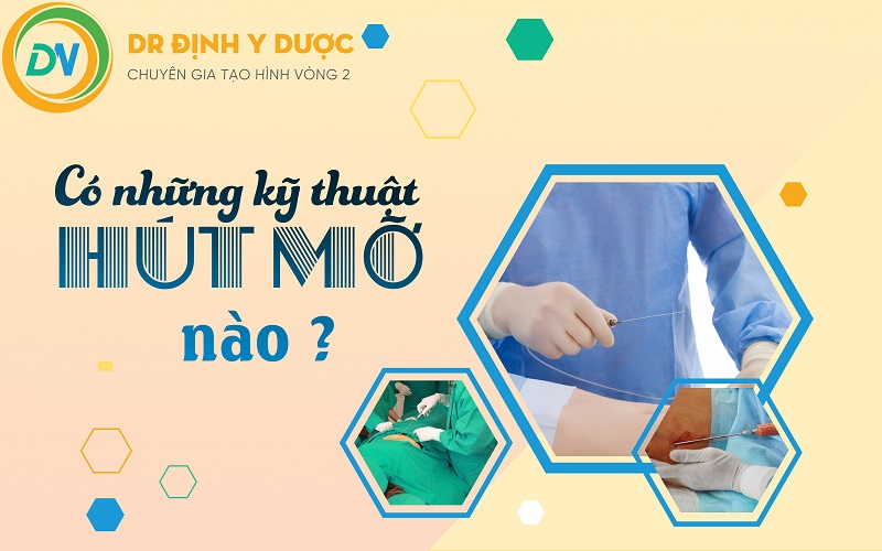 Kỹ thuật hút mỡ