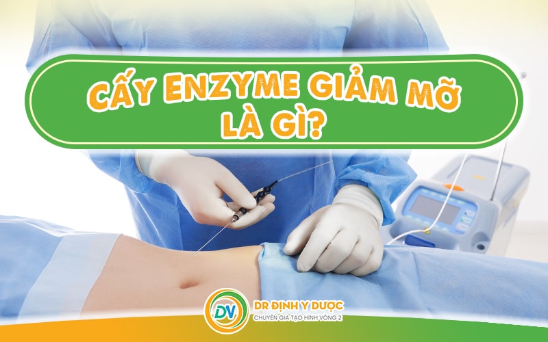 Cấy Enzyme giảm mỡ là gì?