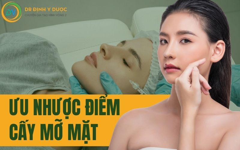 ưu nhược điểm của cấy mỡ mặt