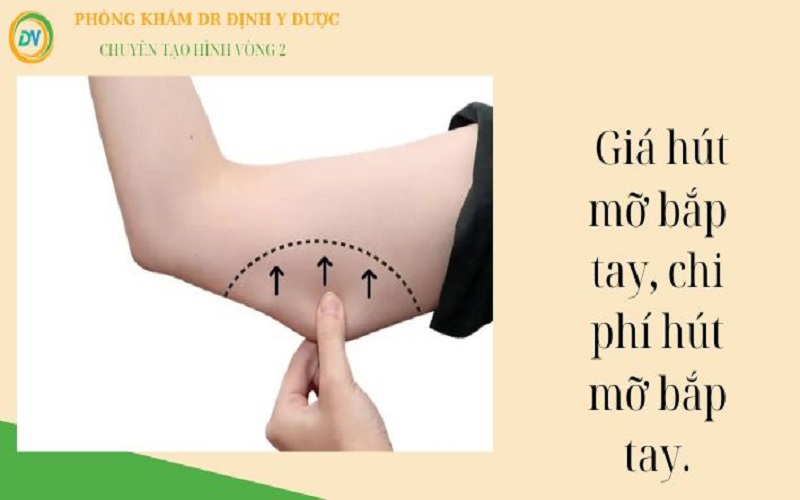 Giá hút mỡ bắp tay