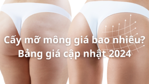 cấy mỡ mông giá bao nhiêu