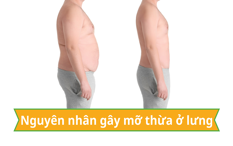 hút mỡ lưng bao nhiêu tiền